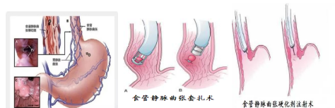 21点游戏