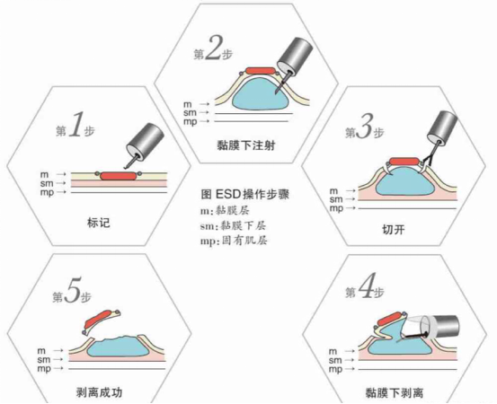21点游戏